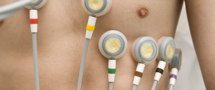 Corso Lettura Elettrocardiogramma ECG